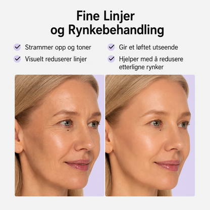 Anti-rynke plaster